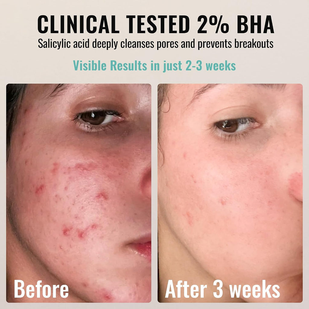 BHA AHA Liquid Exfoliant